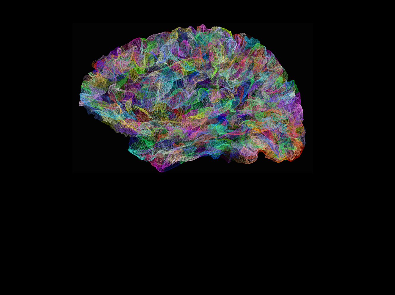 Imaging the Brain: The Martinos Center Celebrates 25 Years of Seeing the Future