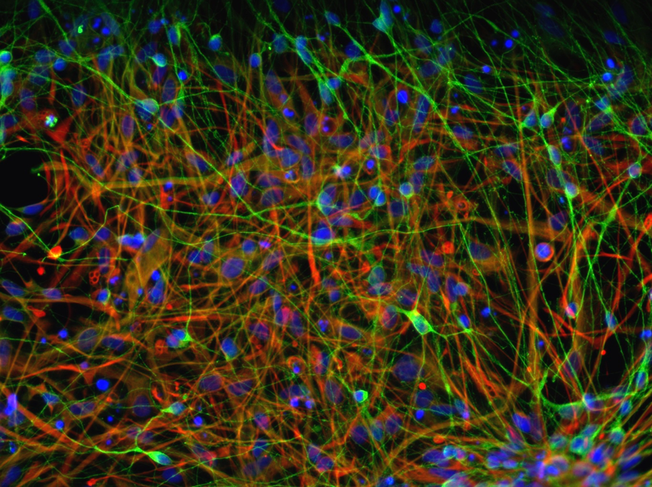 Cracking the Code <br>in Pediatric Bipolar Disorder